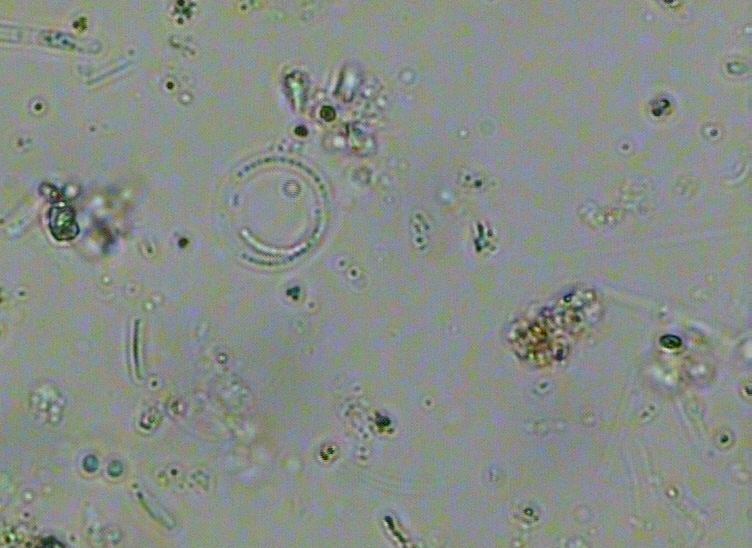 Dictyocha speculum